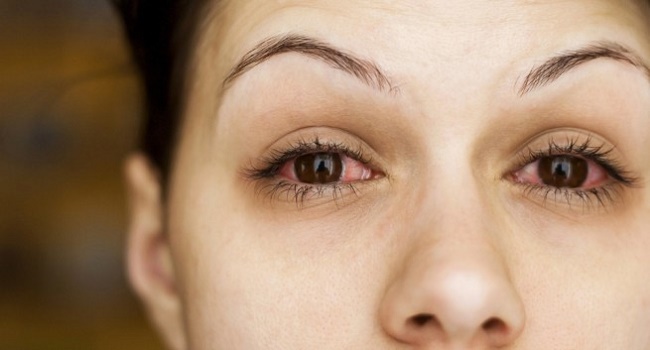 Dầu dừa có thể gây hại cho mắt không?
